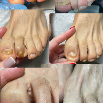 Юлія Симонец, Буча Фото - 9