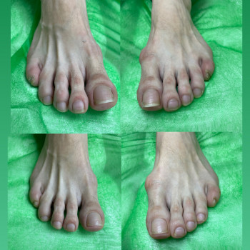 Юлія Симонец, Буча Фото - 10