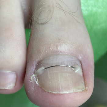 Юлія Симонец, Буча Фото - 11