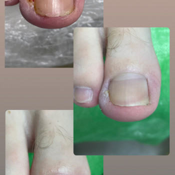 Юлія Симонец, Буча Фото - 12