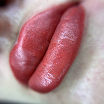 Процедура ПМ губи