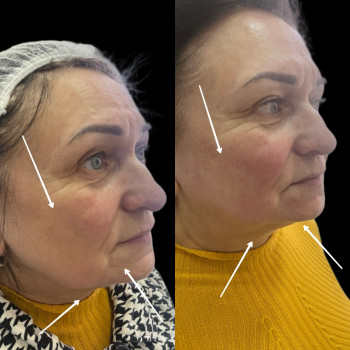 Эстетик Сенсей, Київ Фото - 13