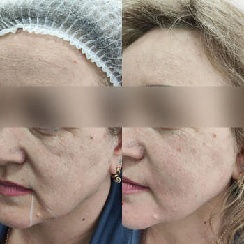 Эстетик Сенсей, Київ Фото - 12