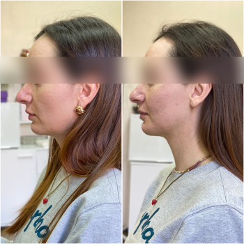 Эстетик Сенсей, Київ Фото - 10