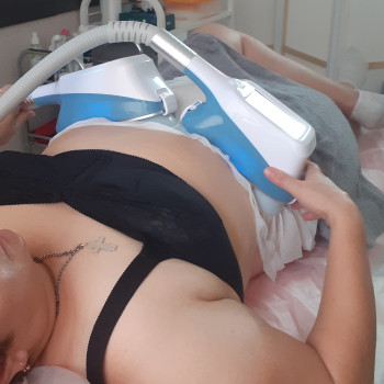 Кріоліполіз зона жівит 2 великі 60 хв