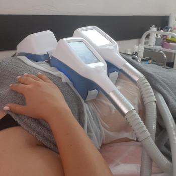 Криолиполиз 
Живіт 3 насадки 
Охолодження до -10 °