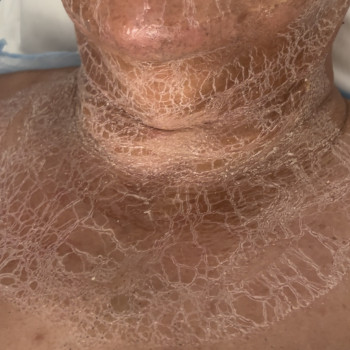 Пептидна терапія CIRCADIA