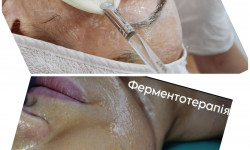 Ферментотерапія Косметолог Юлия Черкассы