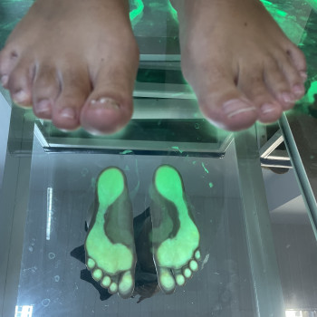 Діагностика стопи