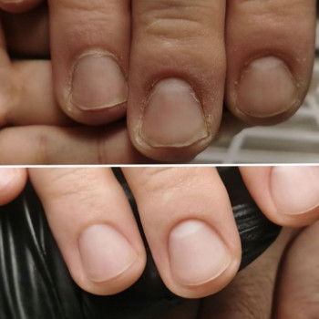 Элина Кива, Одесса Фото - 2