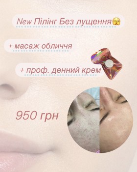Doskonala