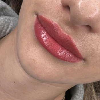 Губи одразу після процедури ПМ