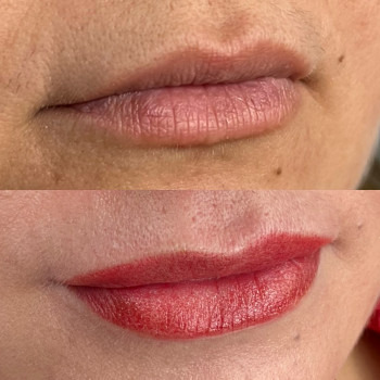 Губи одразу після процедури ПМ