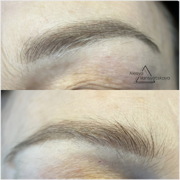 Загоєнні бровки