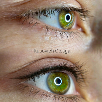 Міжвійна стрілка