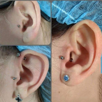 Пірсинг "Трагус" (з титановою прикрасою для первісного проколу)