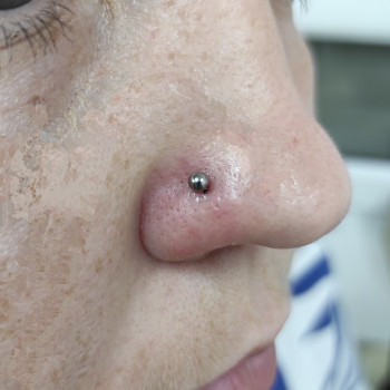 Пірсинг крила носу (з титановою прикрасою для первісного проколу)
