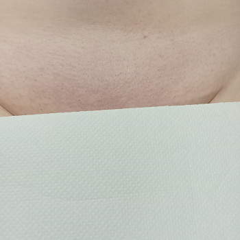 Депiляцiя шугаринг нiг повнiстю
                    Мастер депиляции  Киев