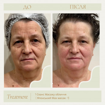 Марія Кіс, Київ Фото - 6