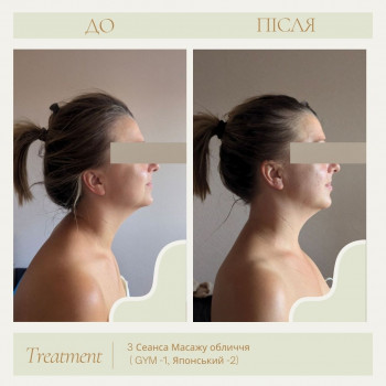 Марія Кіс, Київ Фото - 7