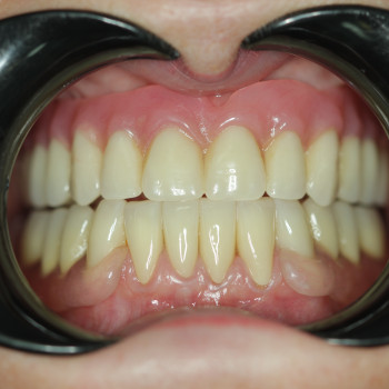 NapDent, Кривой Рог Фото - 2