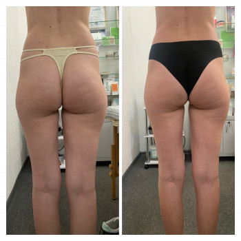 Ольга Барышова, Днепр Фото - 2