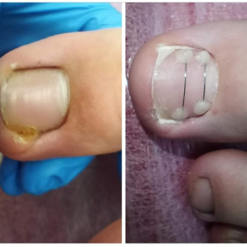 Корекційні системи