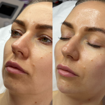 Олександра Славко, Павлоград Фото - 6