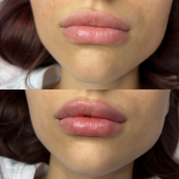 Олександра Славко, Павлоград Фото - 8