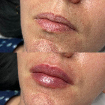 Олександра Славко, Павлоград Фото - 9