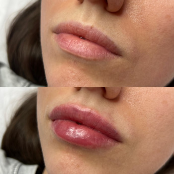 Олександра Славко, Павлоград Фото - 10