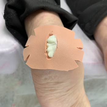 Тріщини
                    Подолог Виктория Харьков