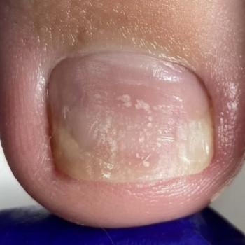 Галина Франчук, Львів Фото - 36