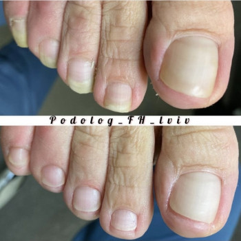 Галина Франчук, Львів Фото - 23