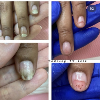 Галина Франчук, Львів Фото - 7