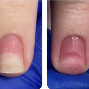 Галина Франчук, Львів Фото - 14