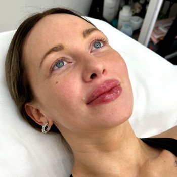 Людмила Ємець, Хмельницький Фото - 46