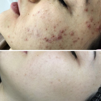 Яна Саманчук, Киев Фото - 1