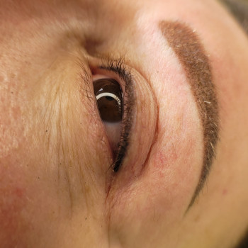 Брівки, міжвійка