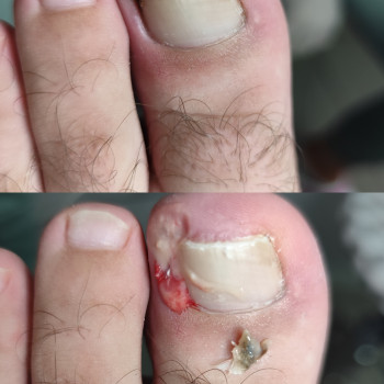 Центр подологии и тейпирования, Запорожье Фото - 28