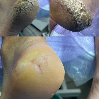 Центр подологии и тейпирования, Запорожье Фото - 31