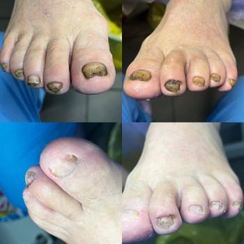 Центр подологии и тейпирования, Запорожье Фото - 26