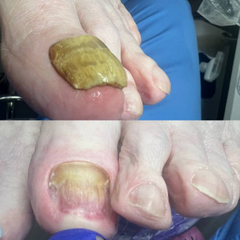 Центр подологии и тейпирования, Запорожье Фото - 34