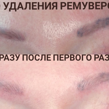 Наталия Дзюбина, Харьков Фото - 70