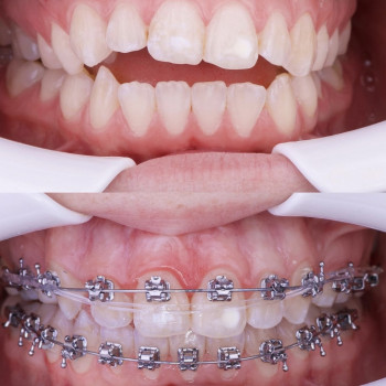 Аліна Степаненко, Київ Фото - 5