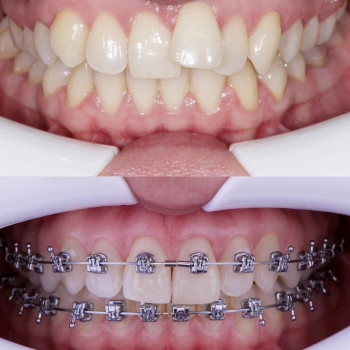 Аліна Степаненко, Київ Фото - 6