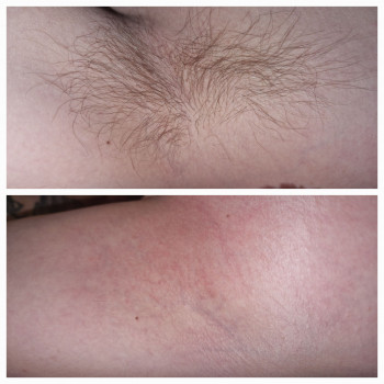 Шугаринг
                    Майстер шугарингу  Дніпро