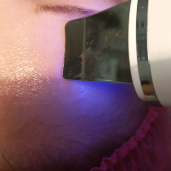 🔥 Акція 💥🔥 
5 в 1💥

Комбінована чистка обличчя+мікрострумова терапія+РФ терапія+Ліфтинговий масаж+Ал...