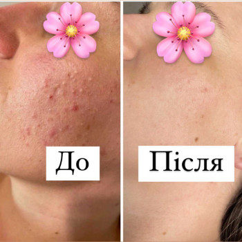 Уляна Деменкова, Київ Фото - 7