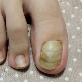 Ірина iMos, Одеса Фото - 11